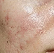 Cera Mieszana